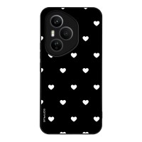 Θήκη Sonique Heart Series για Honor 400 Pro 5G Μαύρο 02