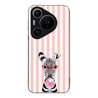 Θήκη Sonique Stripe Stories Series για Huawei Pura 70 Pro Ζέβρα – Τσιχλόφουσκα