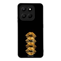 Θήκη Sonique DIVA Series για Honor 400 Smart 4G / Honor 400 Smart 5G / Golden Kisses
