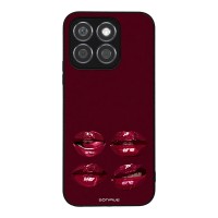 Θήκη Sonique DIVA Series για Honor X8b Κόκκινα Χείλη