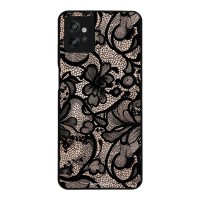 Θήκη Sonique DIVA Series για Motorola Moto G32 Μαύρη Δαντέλα