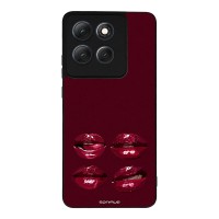 Θήκη Sonique DIVA Series για Motorola Moto G86 5G / Moto G86 5G Power Κόκκινα Χείλη