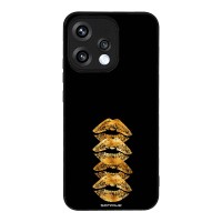 Θήκη Sonique DIVA Series για Oppo Reno15 5G Golden Kisses