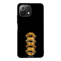 Θήκη Sonique DIVA Series για Xiaomi Mi 11 Lite 4G / Mi 11 Lite 5G Golden Kisses