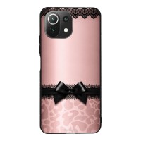 Θήκη Sonique DIVA Series για Xiaomi Mi 11 Lite 4G / Mi 11 Lite 5G Λεοπάρ Φιόγκος – Ροζ