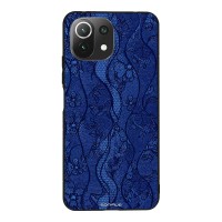 Θήκη Sonique DIVA Series για Xiaomi Mi 11 Lite 4G / Mi 11 Lite 5G Μπλε Δαντέλα