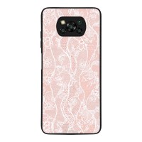 Θήκη Sonique DIVA Series για Xiaomi Poco X3 NFC / Poco X3 Pro Ροζ Δαντέλα