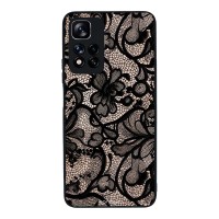 Θήκη Sonique DIVA Series για Xiaomi Redmi Note 11 Pro Plus 5G Μαύρη Δαντέλα