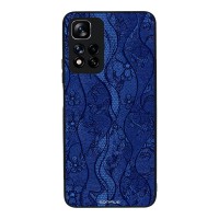 Θήκη Sonique DIVA Series για Xiaomi Redmi Note 11 Pro Plus 5G Μπλε Δαντέλα