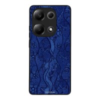 Θήκη Sonique DIVA Series για Xiaomi Redmi Note 13 Pro 4G / Poco M6 Pro 4G / Redmi Note 14S Μπλε Δαντέλα