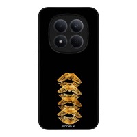 Θήκη Sonique DIVA Series για Xiaomi Redmi Note 15 Pro 5G Golden Kisses