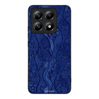 Θήκη Sonique DIVA Series για Xiaomi Xiaomi 14T Μπλε Δαντέλα