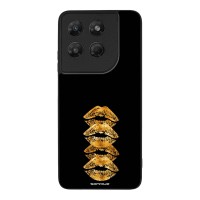 Θήκη Sonique DIVA Series για Motorola Moto G37 5G / Moto G37 Power 5G / Moto G47 5G Golden Kisses