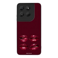 Θήκη Sonique DIVA Series για Motorola Moto G37 5G / Moto G37 Power 5G / Moto G47 5G Κόκκινα Χείλη