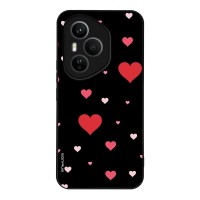 Θήκη Sonique Heart Series για Honor 400 Pro 5G Μαύρο